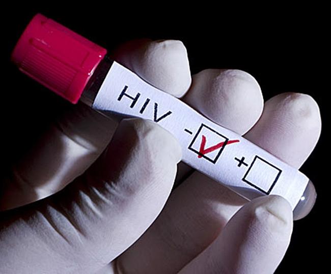 El SES destaca la importancia de hacerse las pruebas del VIH