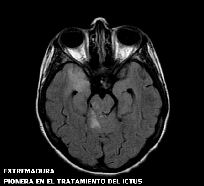 Noticias del año 2014 en Extremadura - segundo semestre - Parte 4