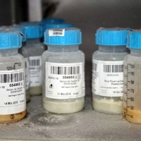 La importancia de donar sangre de cordón umbilical y leche materna