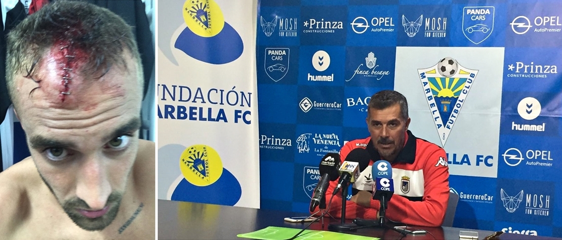 El CD.Badajoz consigue vencer fuera a pesar de la adversidad