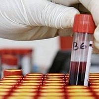 El Comité Ciudadano Antisida realizará pruebas rápidas de VIH