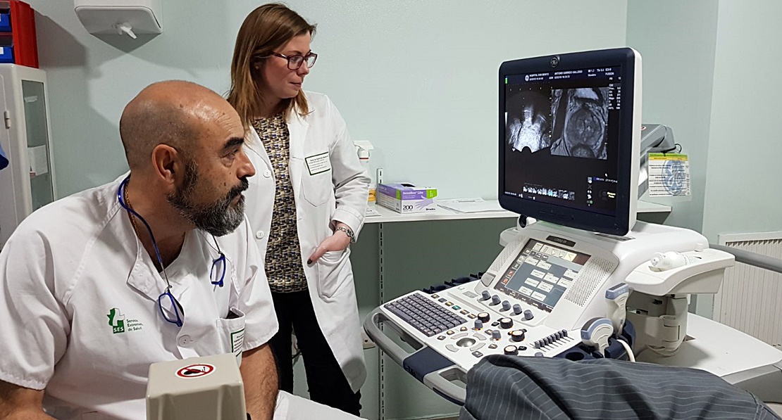 El hospital Don Benito-Villanueva pionero en la biopsia prostática por fusión de imágenes