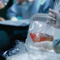 Extremadura registra 20 donaciones de órganos, casi la mitad que en todo 2017