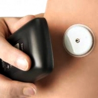 Sanidad compra aparatos para reducir los pinchazos a quienes sufren diabetes