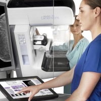 Más de 7.600 extremeñas se someterán a mamografías en mayo
