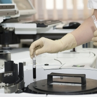 Un fármaco que iba a ser retirado frena el cáncer de vejiga