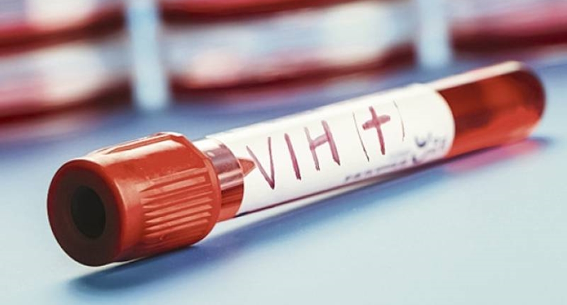 En España el 47,6 % de los diagnósticos por VIH son tardíos