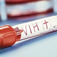 Cerca de 300 personas en Extremadura desconocen que tienen VIH