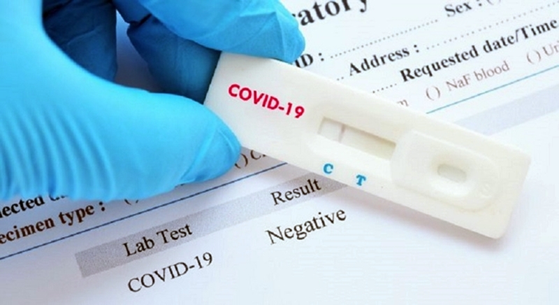“Va haber suficientes test para toda la población”