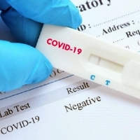 “Habrá suficientes test para toda la población”