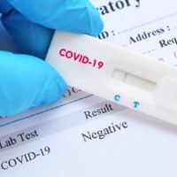 Esta semana comenzarán las pruebas para detectar miles de contagios ocultos