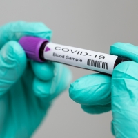 ESPAÑA: Récord de fallecidos por coronavirus en 24 horas ESPAÑA: Récord de fallecidos por coronavirus en 24 horas