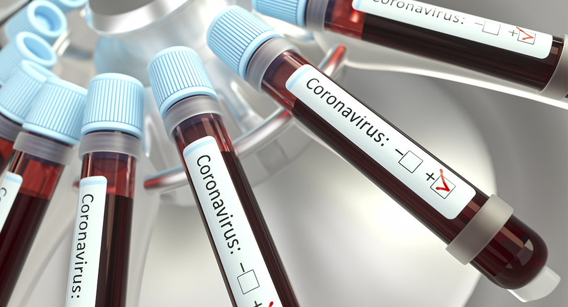 Cómo y quién utilizará los test rápidos llegados a Extremadura
