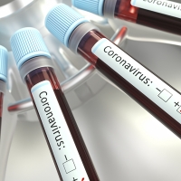 Cómo y quién utilizará los test rápidos llegados a Extremadura