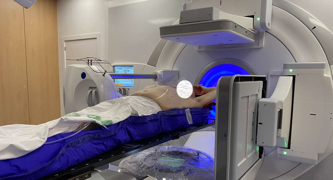 Badajoz implanta una técnica de radioterapia de alta precisión para tratar el cáncer