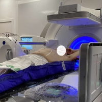 Badajoz implanta una técnica de radioterapia de alta precisión para tratar el cáncer
