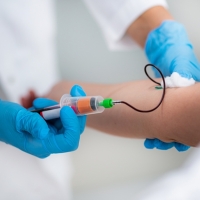 Un análisis de sangre detecta el cáncer con 4 años de antelación
