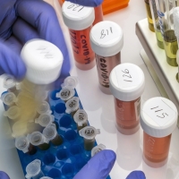 La vacuna rusa podría poner en riesgo a las personas