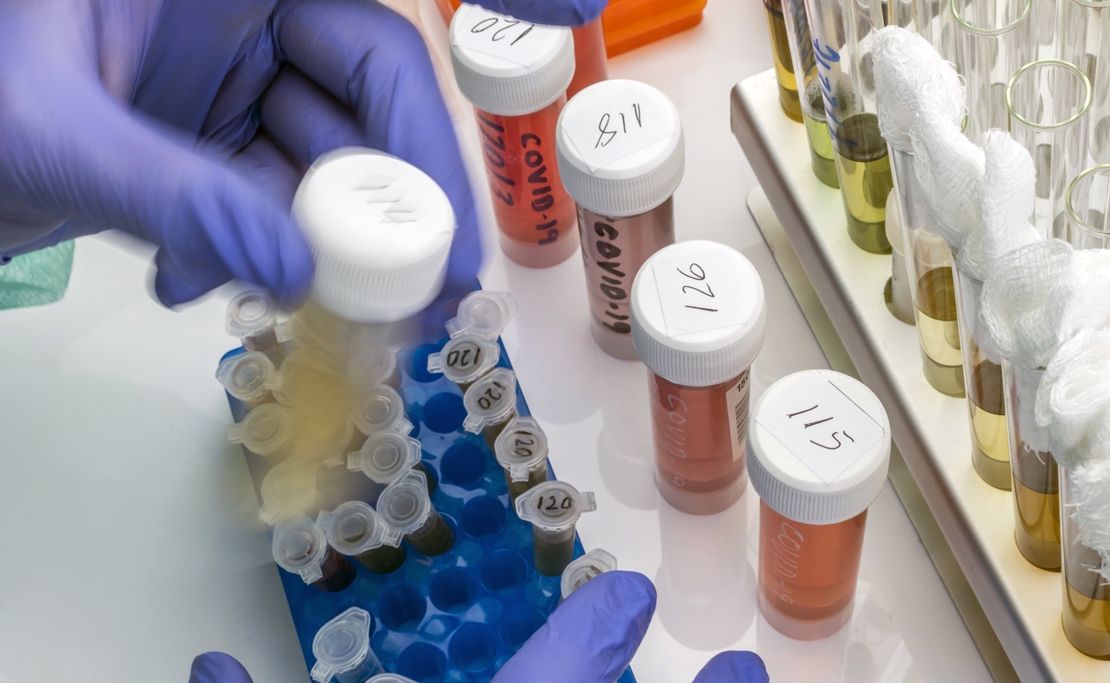 La vacuna rusa podría poner en riesgo a las personas