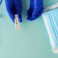 Detalles y preguntas frecuentes sobre los test de anticuerpos en farmacias extremeñas