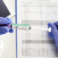 El SES estudia un brote en el norte de Cáceres de la variante brasileña