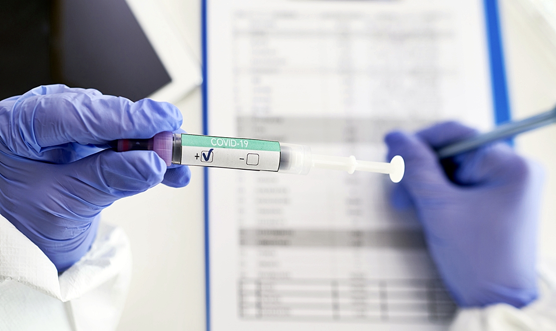 El SES estudia un brote en el norte de Cáceres de la variante brasileña