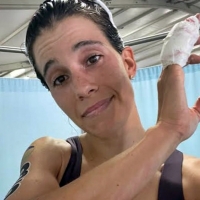 Miriam Casillas finaliza la temporada con un dedo roto