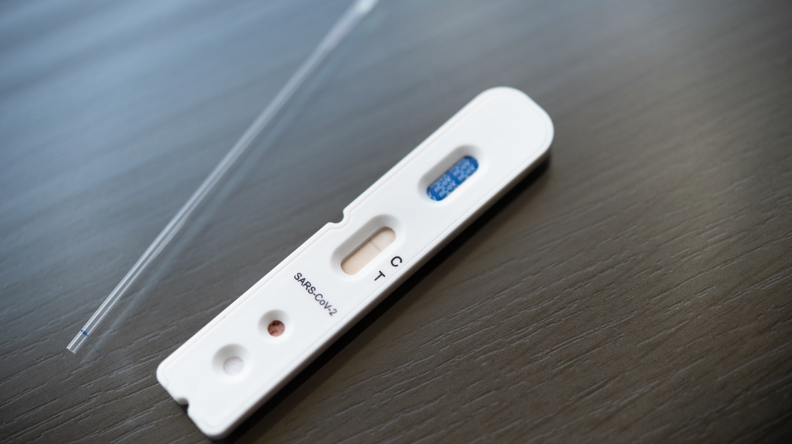 Lanzan un test de antígenos que diferencia el Covid de la gripe