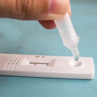 Retiran este test de antígenos vendido en España por dar falsos positivos