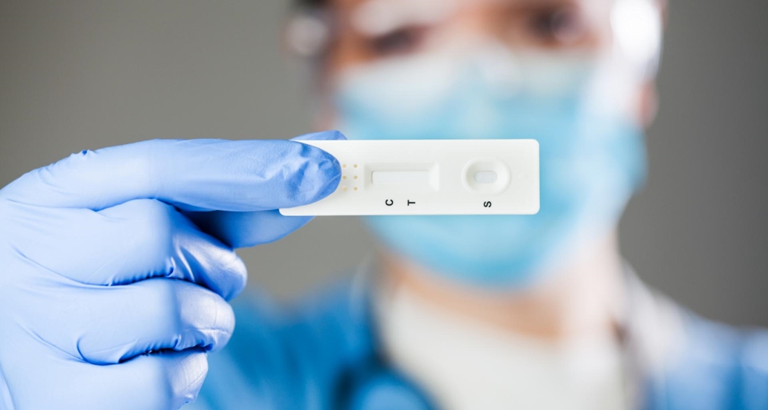El Gobierno fijará el precio máximo de los test de antígenos este jueves