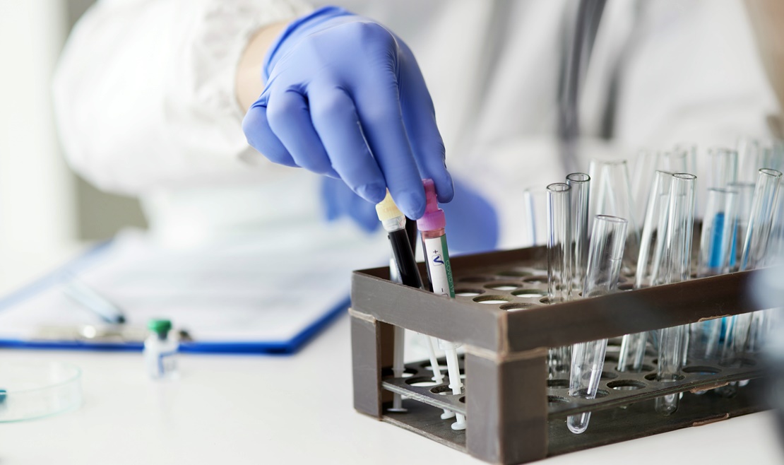 La OMS pide de nuevo a China que ayude a dar con el origen del coronavirus
