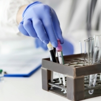 La OMS pide de nuevo a China que ayude a dar con el origen del coronavirus