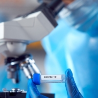 Un estudio muestra cómo cambia el cerebro tras una infección por covid