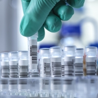 La OMS pide a Ucrania que destruya los virus peligrosos que guarda en sus laboratorios
