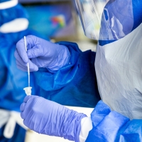 Los anticuerpos podrían predecir la evolución del covid en los no vacunados