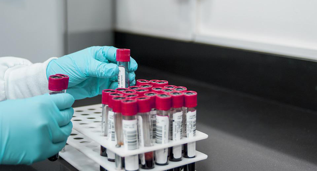 Aumento considerable de las infecciones de transmisión sexual en mujeres en los últimos años