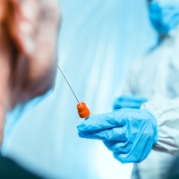 Epidemiólogos advierten ante el avance del nuevo coronavirus