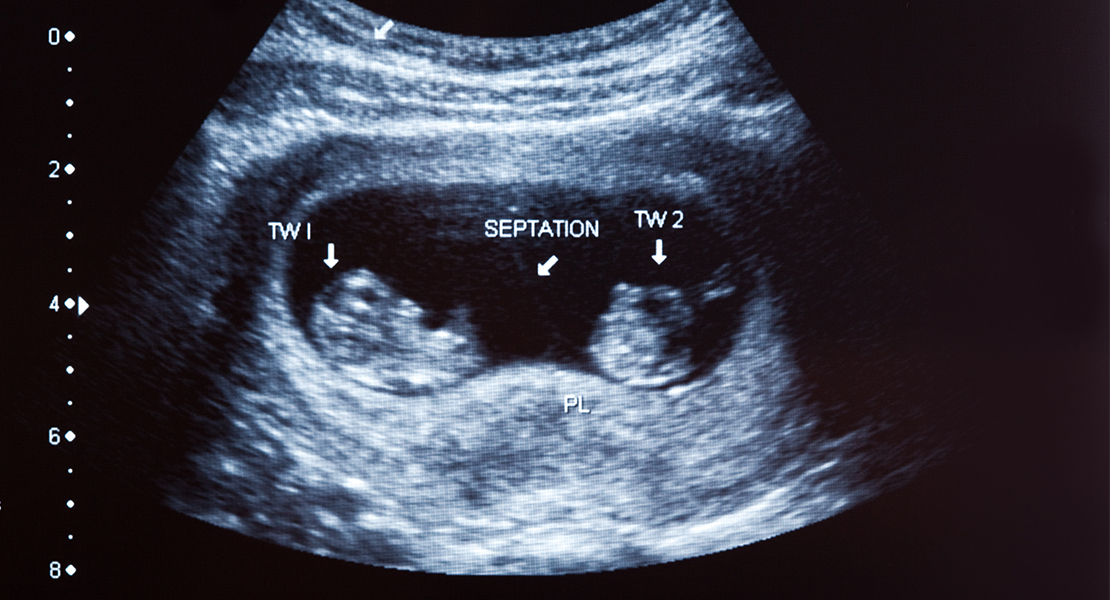 OPINIÓN: Aborto. ¿Puede haber algo más definitivo que la muerte?