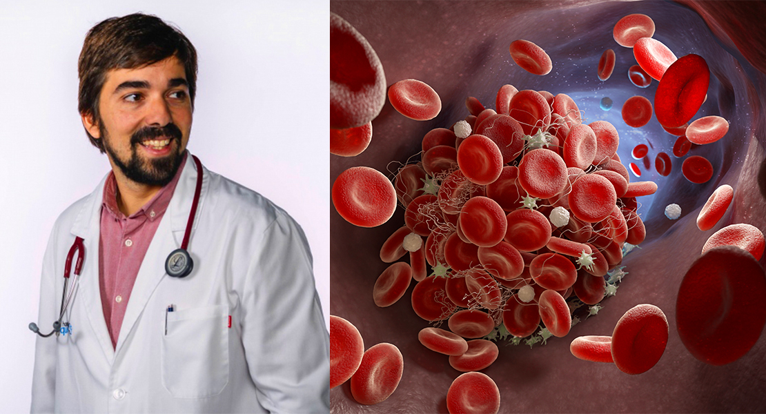 La trombosis arterial, &quot;principal causa de muerte en Extremadura&quot;