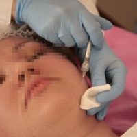 Dermatólogo/a, perfil mejor pagado del sector sanitario en España en 2022