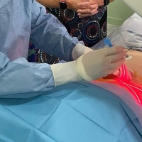 El Hospital Don Benito-Villanueva realiza las primeras descompresiones de hernias discales mediante láser