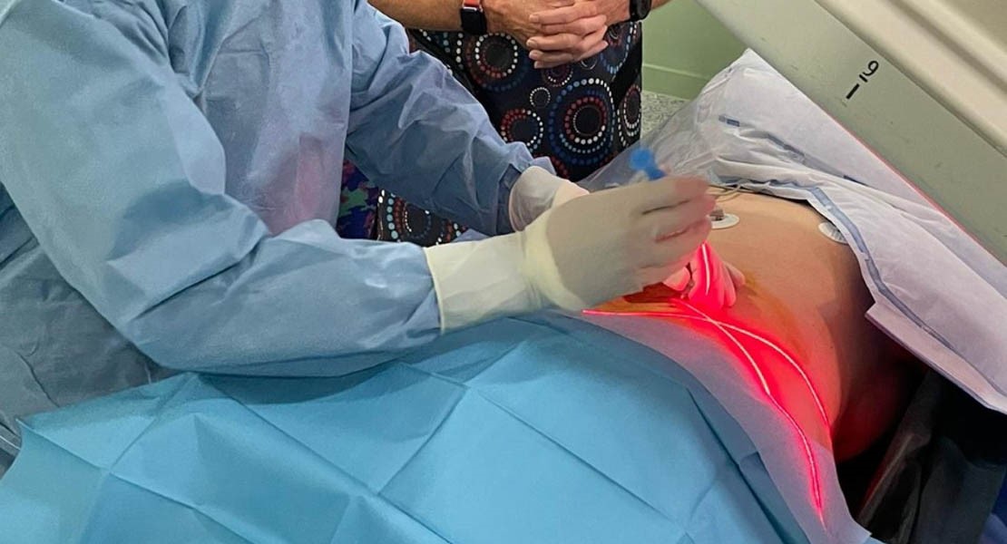 El Hospital Don Benito-Villanueva realiza las primeras descompresiones de hernias discales mediante láser
