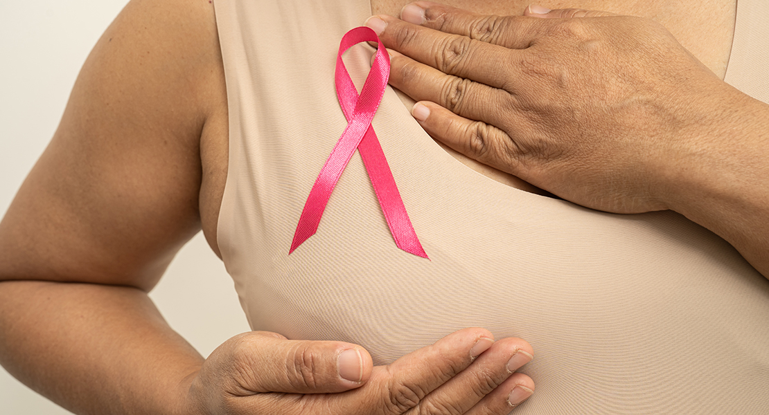 Las mujeres operadas de cáncer de mama protagonistas de un desfile de lencería y baño en Badajoz
