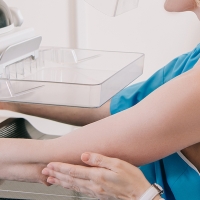 El SES llama a 9.000 mujeres para realizarse mamografías en junio