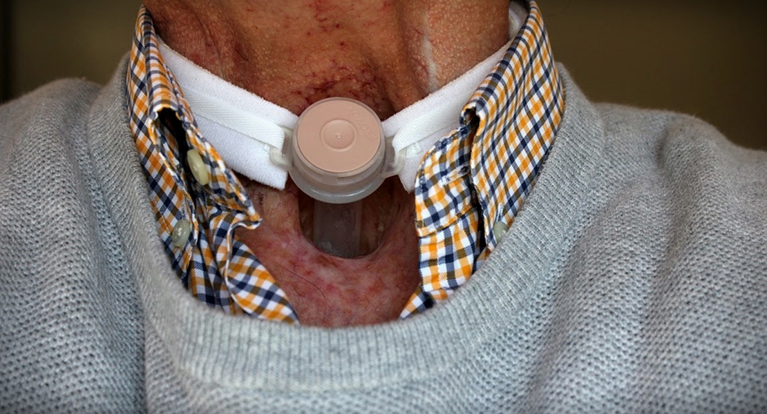 20 años ayudando a los pacientes de cáncer de laringe desde la AECC de Badajoz