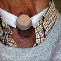 20 años ayudando a los pacientes de cáncer de laringe desde la AECC de Badajoz