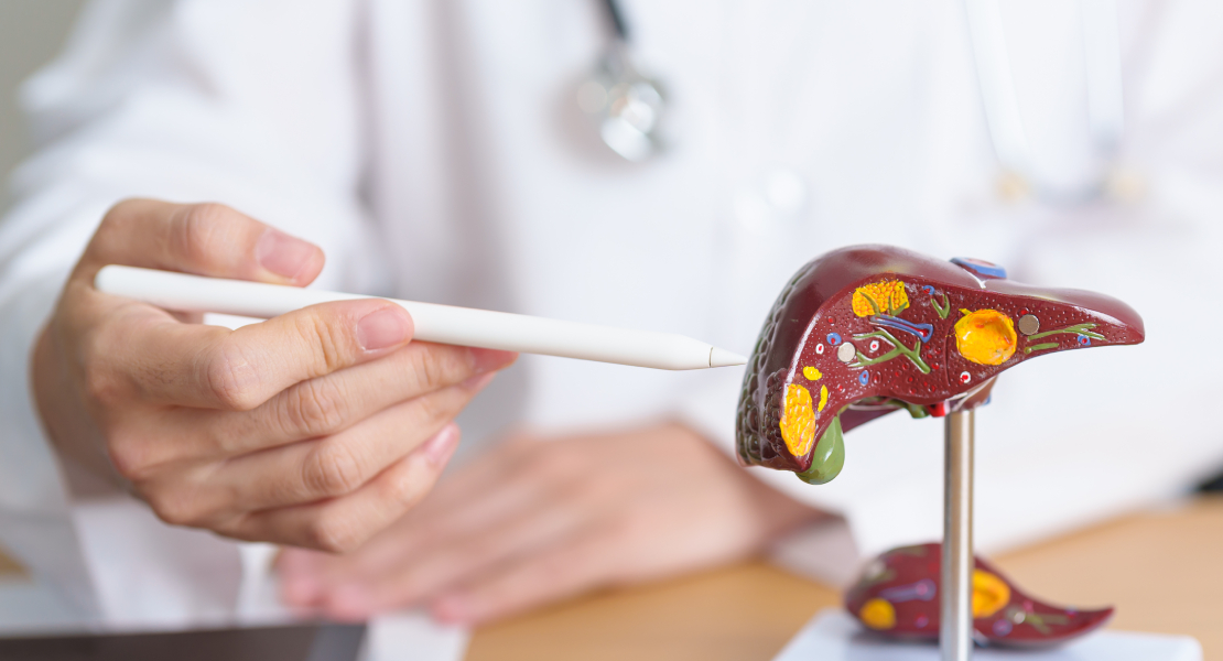 Esta es principal causa del cáncer de hígado, que podría afectar a 21.000 extremeños