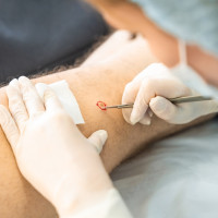 Trabajan para que una herramienta innovadora de IA pueda diagnosticar enfermedades de la piel