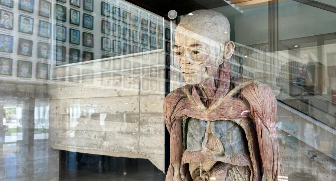 El Centro de Cirugía de Mínima Invasión de Cáceres expone 12 cuerpos humanos reales