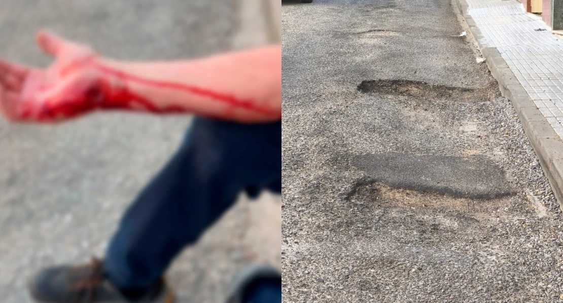 Herido tras sufrir una caída en una calle en mal estado de Badajoz